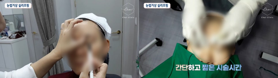 이마실리프팅 부작용 걱정되신다면 ‘이것’ 중요합니다 관련 이미지 4