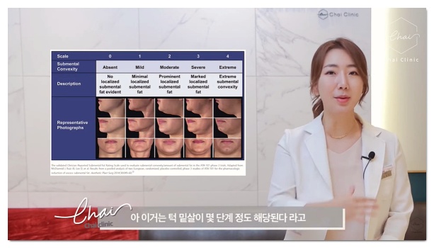 이중턱살 주사 무엇을 맞을까? 윤곽주사, 지방분해주사 선택법 관련 이미지 3