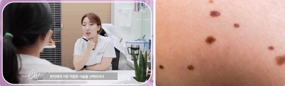 홍대점빼기, 확실하게 관련 이미지 4