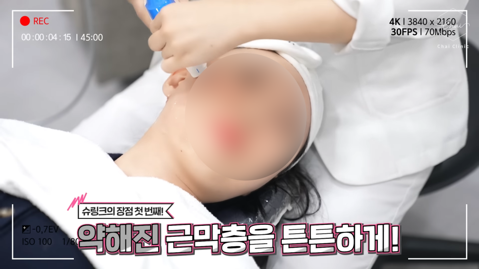합정 슈링크 원리 효과 울쎄라보다 오래갈까? 관련 이미지 2