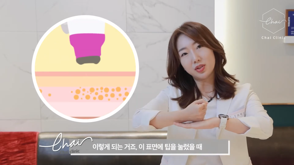 홍대 써마지 FLX 시술하기 전에 정품 팁 확인은 반드시 해야 합니다. 관련 이미지 6