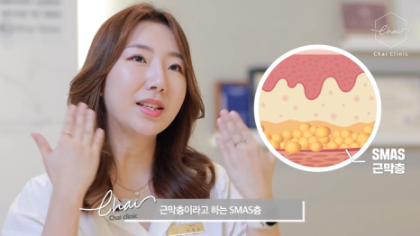 합정 울쎄라 효과 부작용은 없을까? 관련 이미지 3