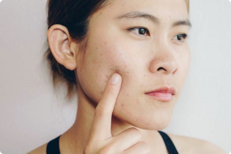홍대입구역피부관리 가성비 좋은 리프팅 방법을 찾고 있다면 필독! 관련 이미지 2