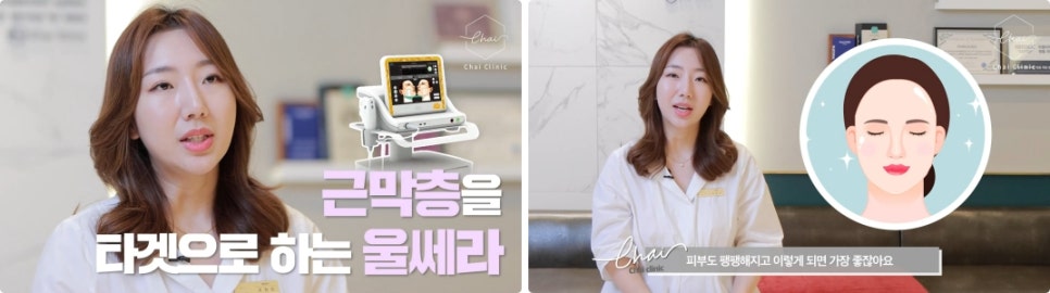 문신지우기? 레이저로 확실히 조사놔야~ 깨끗해질 수 있어요^^ 관련 이미지 9