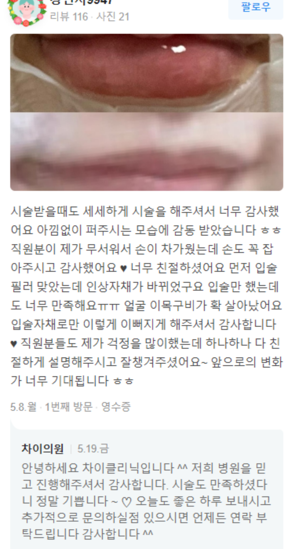 바디지방분해주사 다이어트 30분 컷, 비키니 시작! 관련 이미지 13