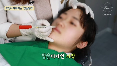 홍대필러, 입술필러로 동안이미지 만들어봐요 관련 이미지 8