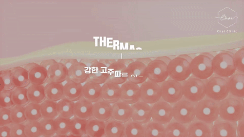 합정 써마지 30대&middot;40대&middot;50대 연령별로 달라지는 디자인 관련 이미지 4