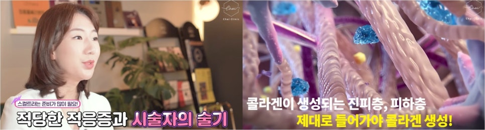 땅콩얼굴형 매끈하게 예뻐지는 방법 관련 이미지 8