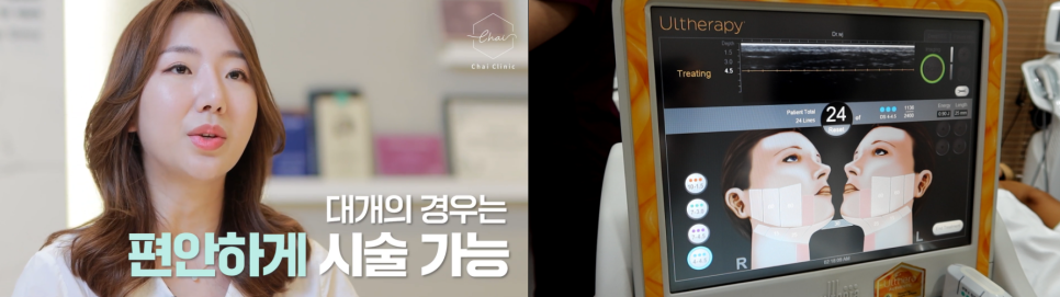 목거상술 흉터가 고민된다면? 관련 이미지 8