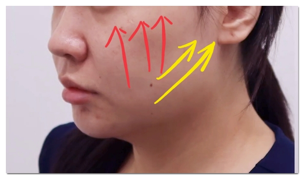 Hongdae Ultherapy PRIME? You’ll Regret It If You Choose a Place Like This image 6