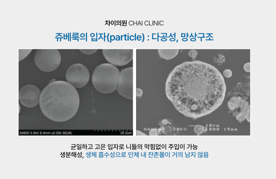 쥬베룩 볼륨 효과를 높이는 쥬베룩 리프팅 런칭! 관련 이미지 5