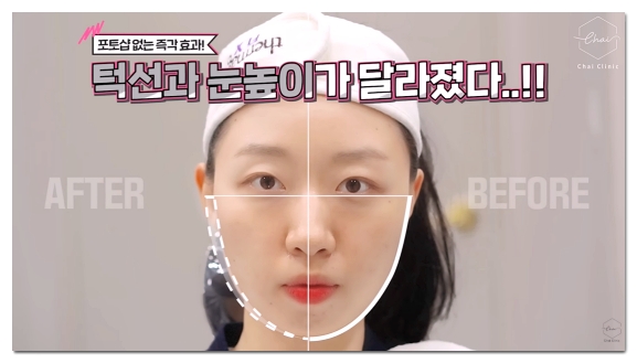 슈링크 효과 언제부터일까? 시기별 효과 및 유지기간 총정리 관련 이미지 6