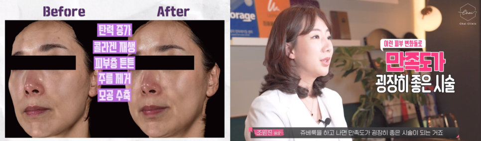 피코프락셀 주기와 관리 방법 차이에서 알려 드려요 관련 이미지 5