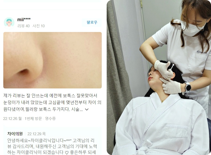 피코레이저 가격, 색소침착을 효과적으로 개선 하고 싶다면 관련 이미지 9