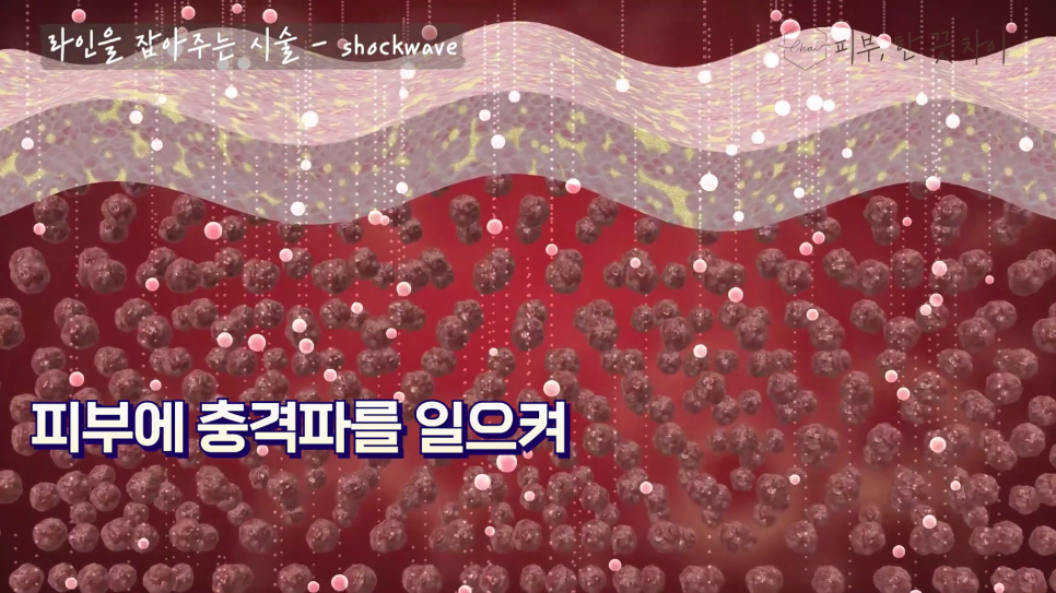 홍대 다이어트, 군살 쉽게 빼는 다이어트 시술 6가지 관련 이미지 13