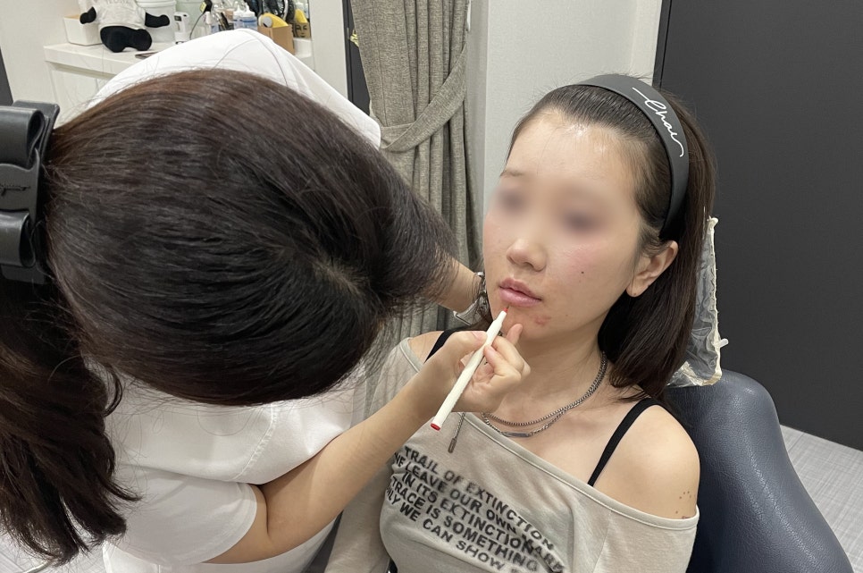 홍대 입술필러, 부작용 예방하려면 관련 이미지 4