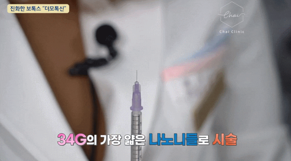 팔자주름보톡스 A부터 Z까지 파헤쳐 드려요 관련 이미지 8