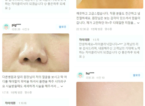 눈리프팅 효과를 120% 더 낼 수 있는 시술 대공개! 관련 이미지 13
