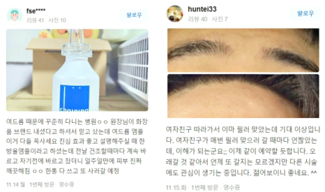 눈리프팅 효과를 120% 더 낼 수 있는 시술 대공개! 관련 이미지 17