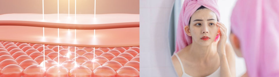 상암동피부관리, 3살 어려지는 마법을 경험하실거예요~ 관련 이미지 6