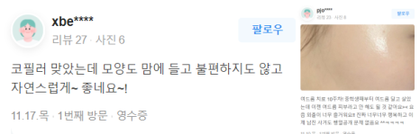 홍대여드름흉터 제거 가장 효과적인 제거 방법은? 관련 이미지 19