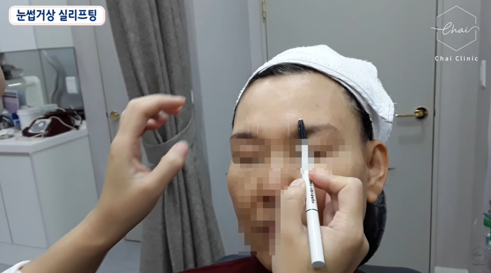 Avoid These 3 Types of Thread Lifting Side Effects in Hongdae image 5