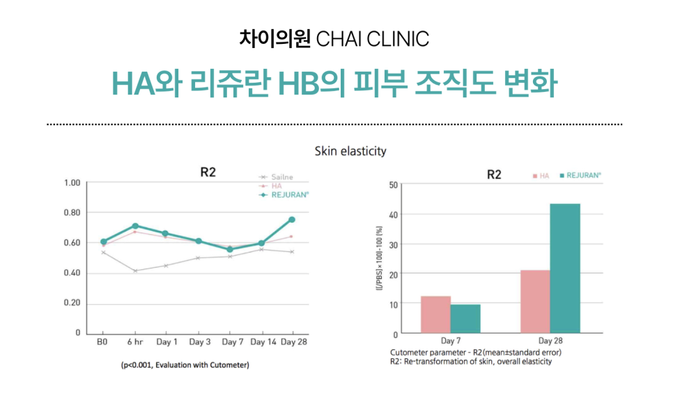 리쥬란 HB 통증에 대한 견해 관련 이미지 1