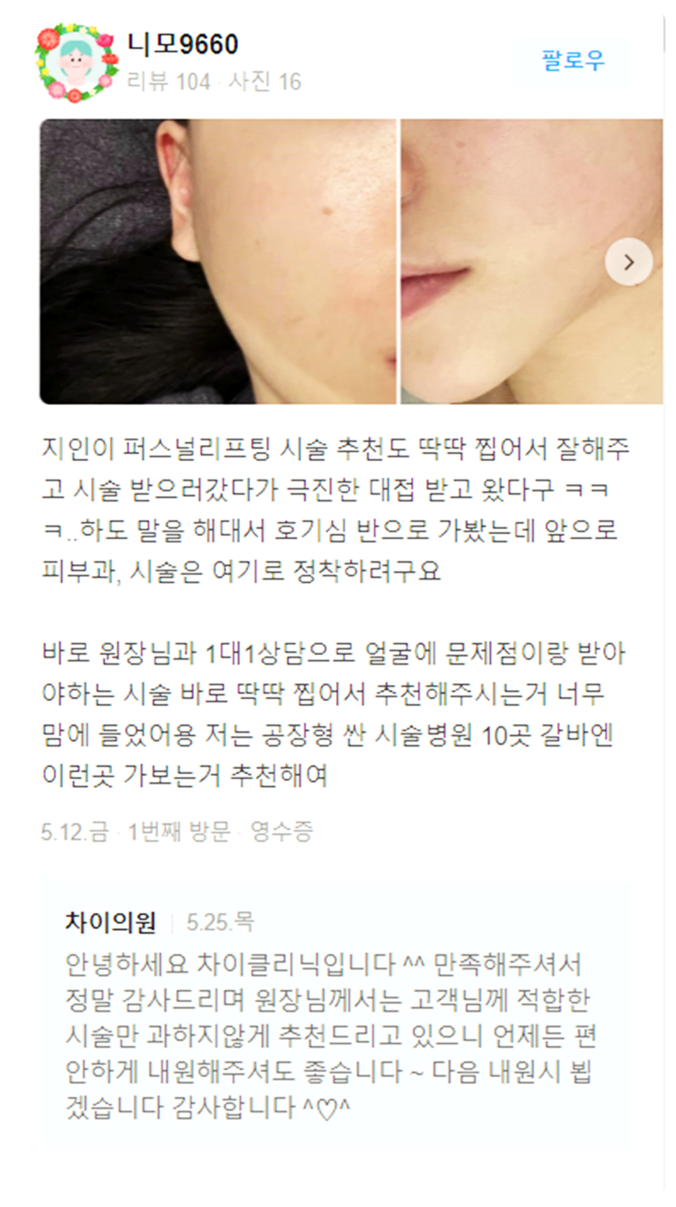 목주름레이저 타임머신효과, 탄력있는 목을 유지하세요! 관련 이미지 20