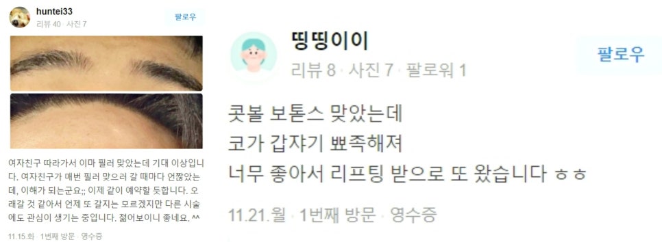 V라인 리프팅, 관련 이미지 25