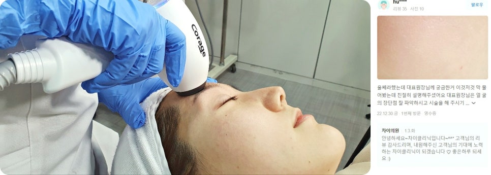피코레이저 가격, 색소침착을 효과적으로 개선 하고 싶다면 관련 이미지 12