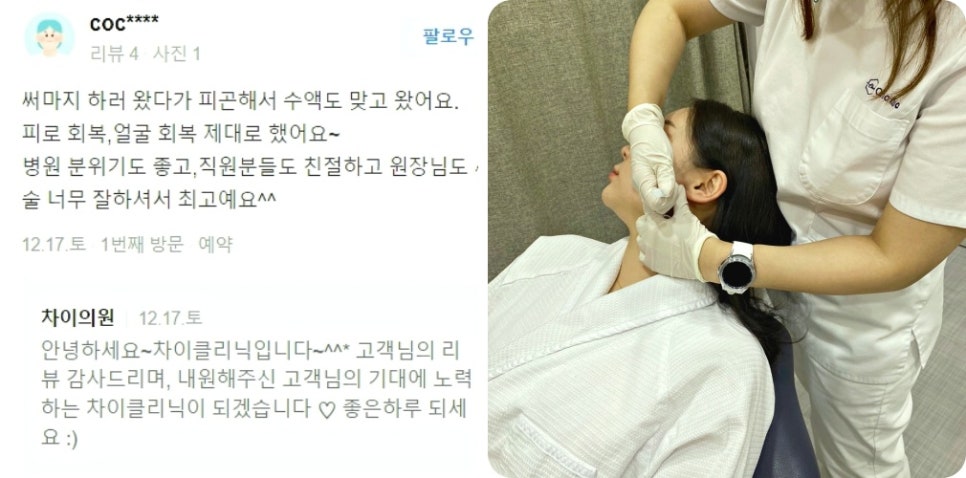 레이저리프팅 관련 이미지 12
