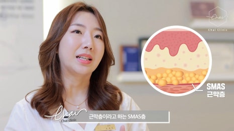아이울쎄라 통해 예쁜 눈웃음으로 거듭나기! 관련 이미지 9
