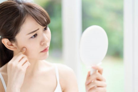 광대보톡스 달덩이 얼굴 이젠 안녕 관련 이미지 2