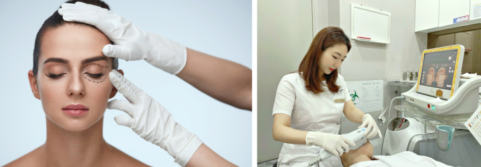 눈꺼풀리프팅 또렷하고 시원한 눈매를 위한 2가지 시술 추천 관련 이미지 19