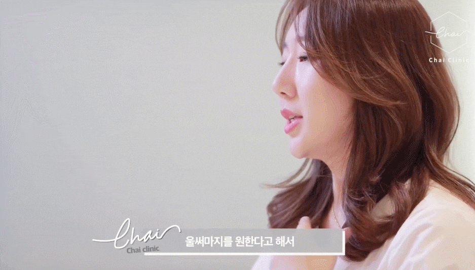 써마지 전후 차이 확실하게 보여드립니다 관련 이미지 2