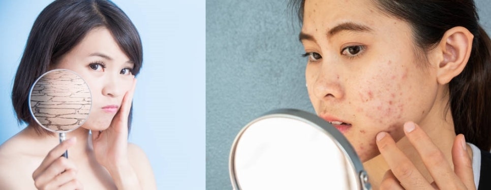 마포피부관리 확실한 리프팅 효과를 원하신다면! 관련 이미지 2