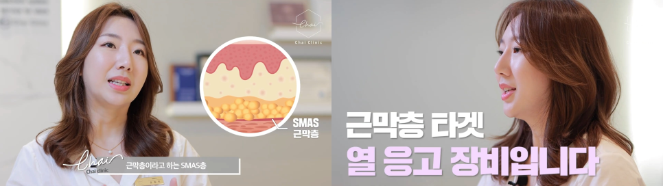 울쎄라팔자주름 울쎄라 실력자가 강조하는 &lsquo;이것&rsquo;! 관련 이미지 7
