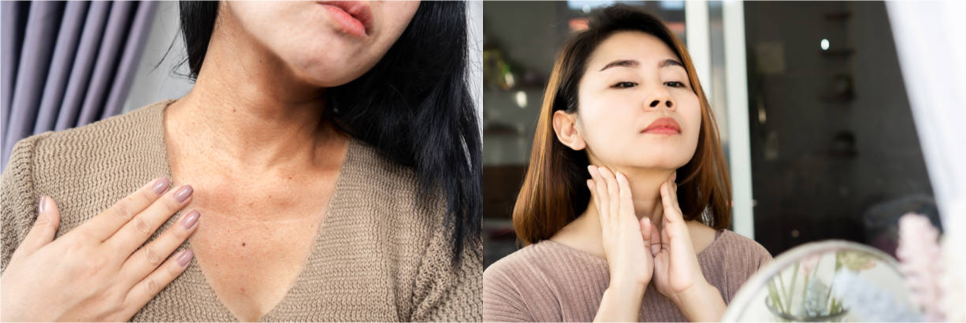 목리프팅 목주름을 확실하게 없애고 싶은 분들만 꼭 보세요. 관련 이미지 3