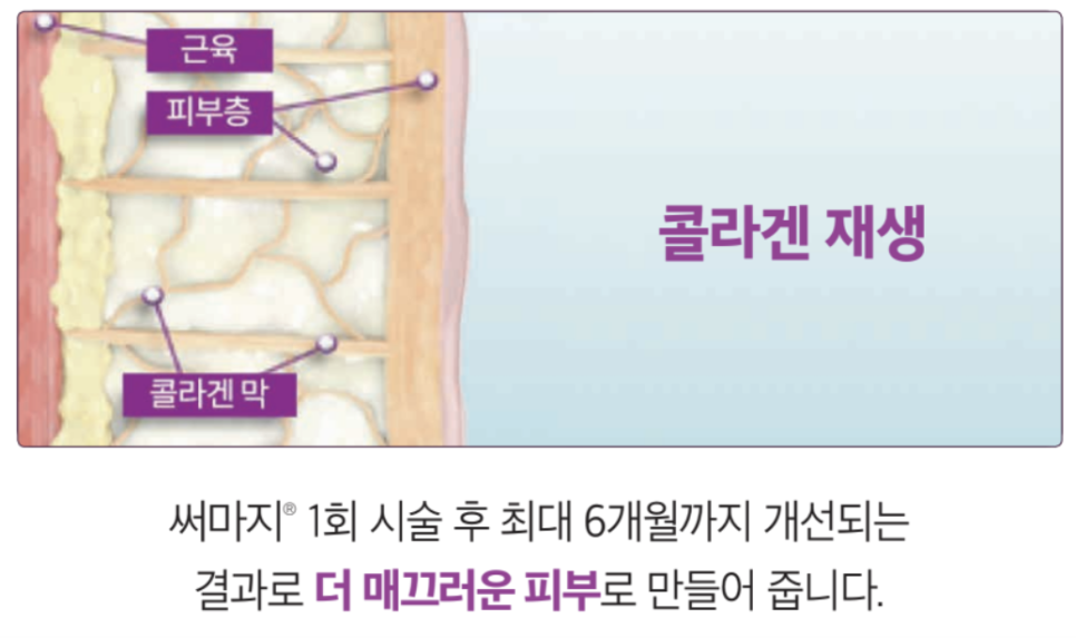 고주파 리프팅 종류와 차이의원의 리프팅 솔루션 관련 이미지 12