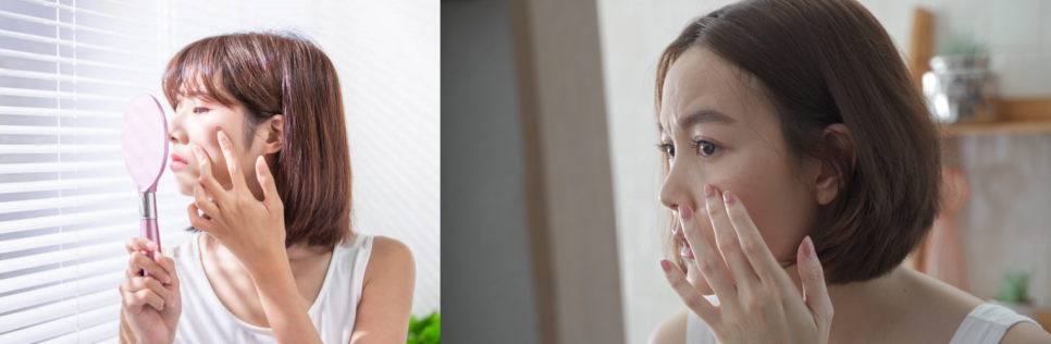 눈꼬리 올리기의 최강자, 아이 울쎄라 vs 아이 써마지 관련 이미지 1