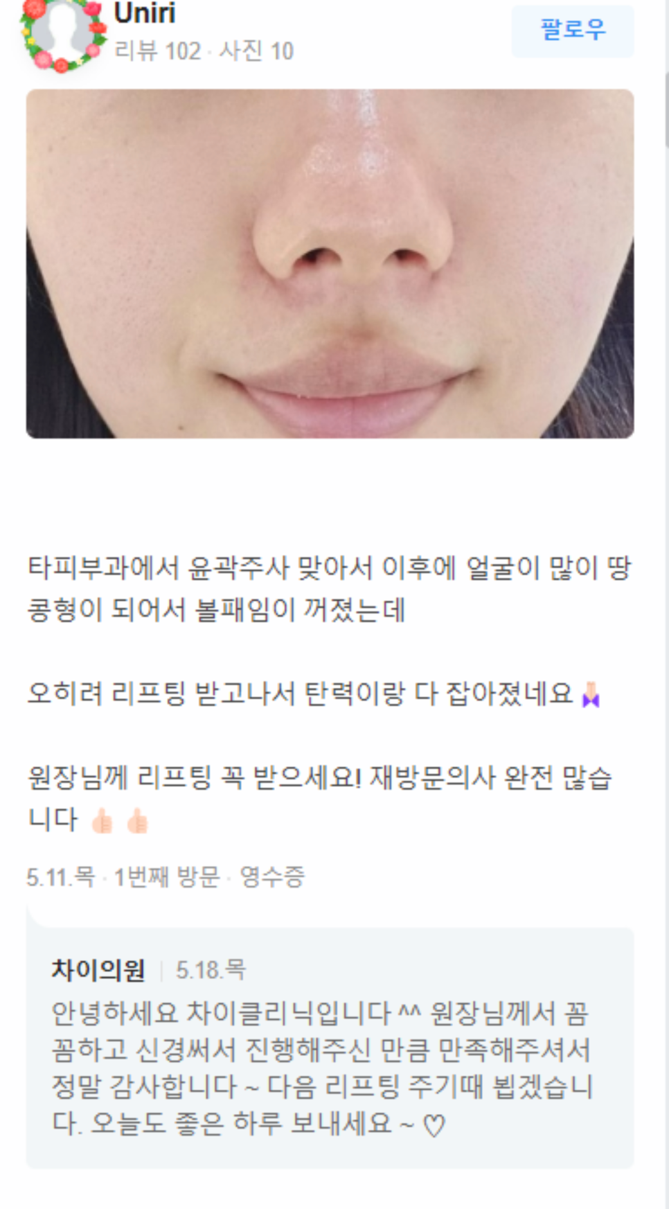 팔뚝 울핏 쉽고 빠르게 가녀린 팔 라인 완성 관련 이미지 16