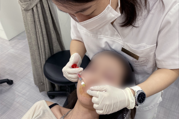 Hongdae Lip Filler: A Complete Guide to Pain, Swelling, and Design Before and After image 9