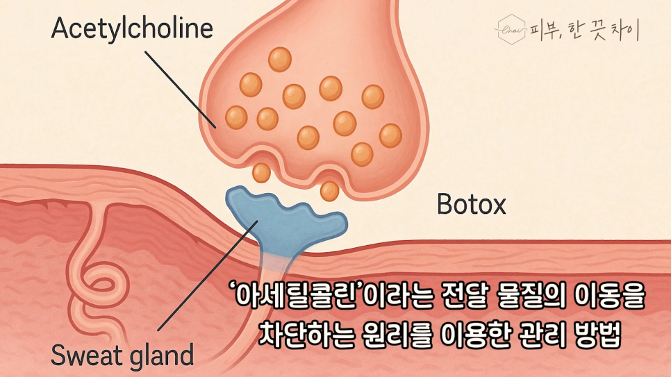 Hongdae Botox for Those Worried About Summer Hyperhidrosis image 8