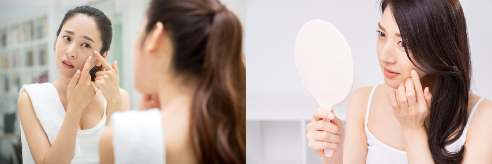 기미 레이저토닝 높은 효과는 OO에서 차이납니다. 관련 이미지 3
