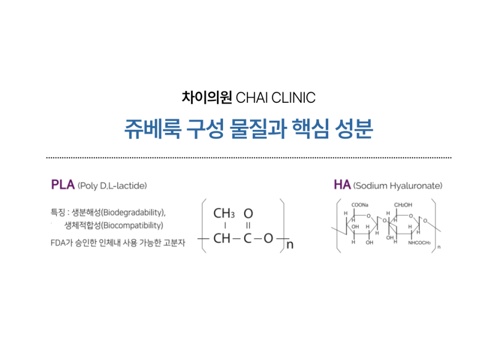 눈밑 쥬베룩 볼륨의 효과와 유지기간 관련 이미지 7