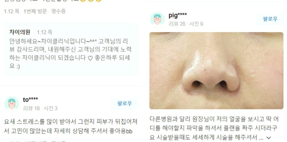 레이저리프팅 관련 이미지 13