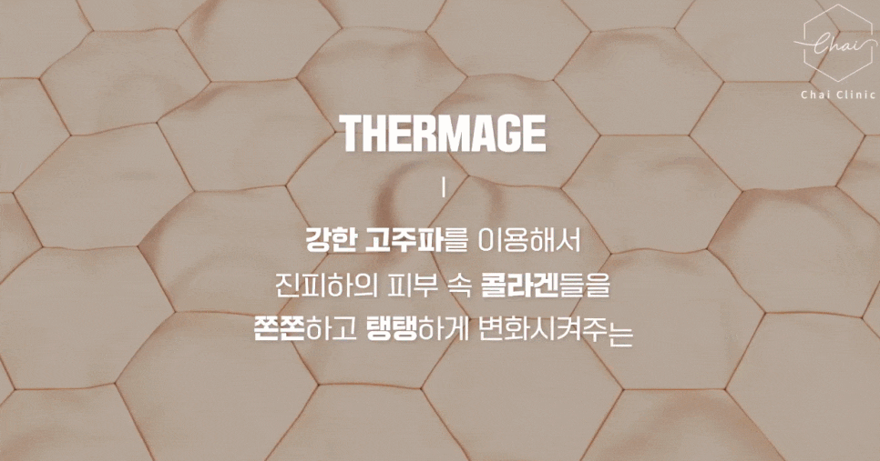 목거상술 흉터가 고민된다면? 관련 이미지 9