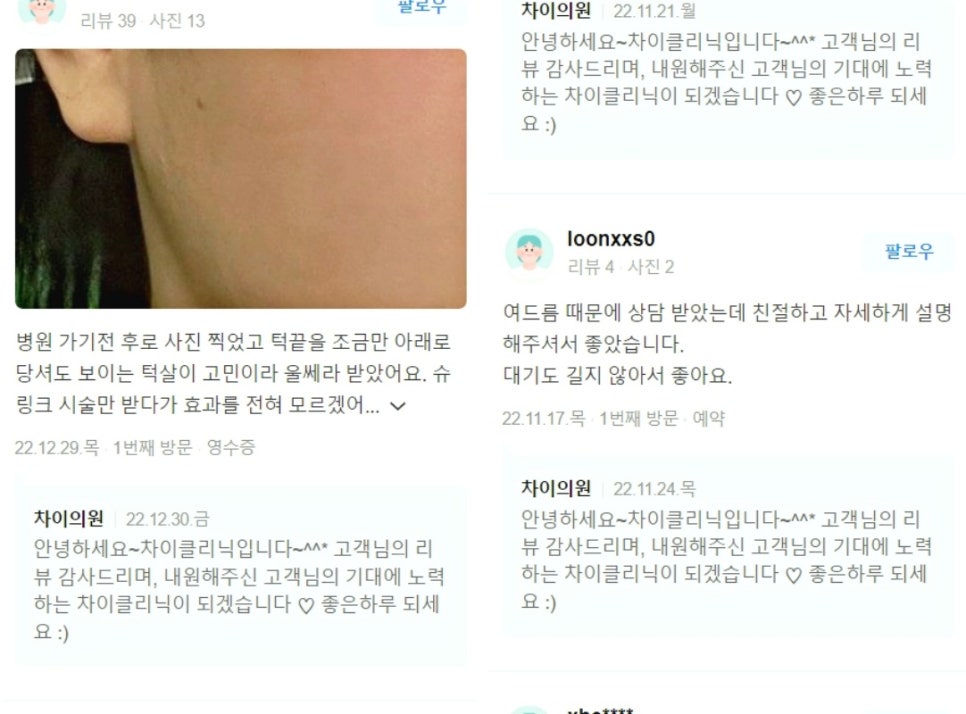 레이저리프팅 관련 이미지 16