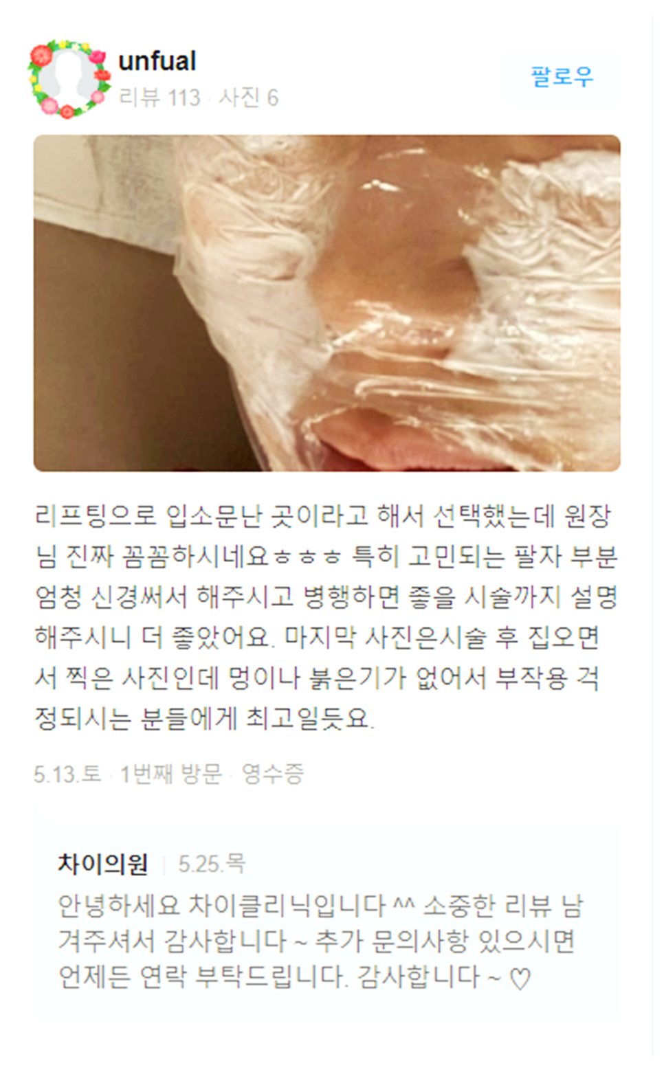 목주름레이저 타임머신효과, 탄력있는 목을 유지하세요! 관련 이미지 21