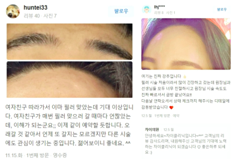이중턱시술, 선명하고 뚜렷한 인상을 위해서는 ‘이것’이 중요해요. 관련 이미지 16